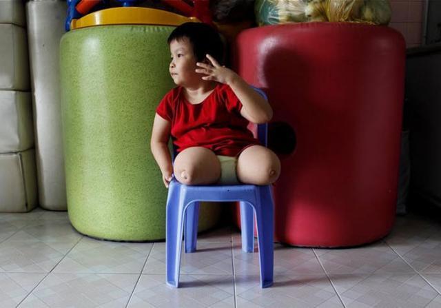 Каждый год сотни детей во Вьетнаме рождаются инвалидами